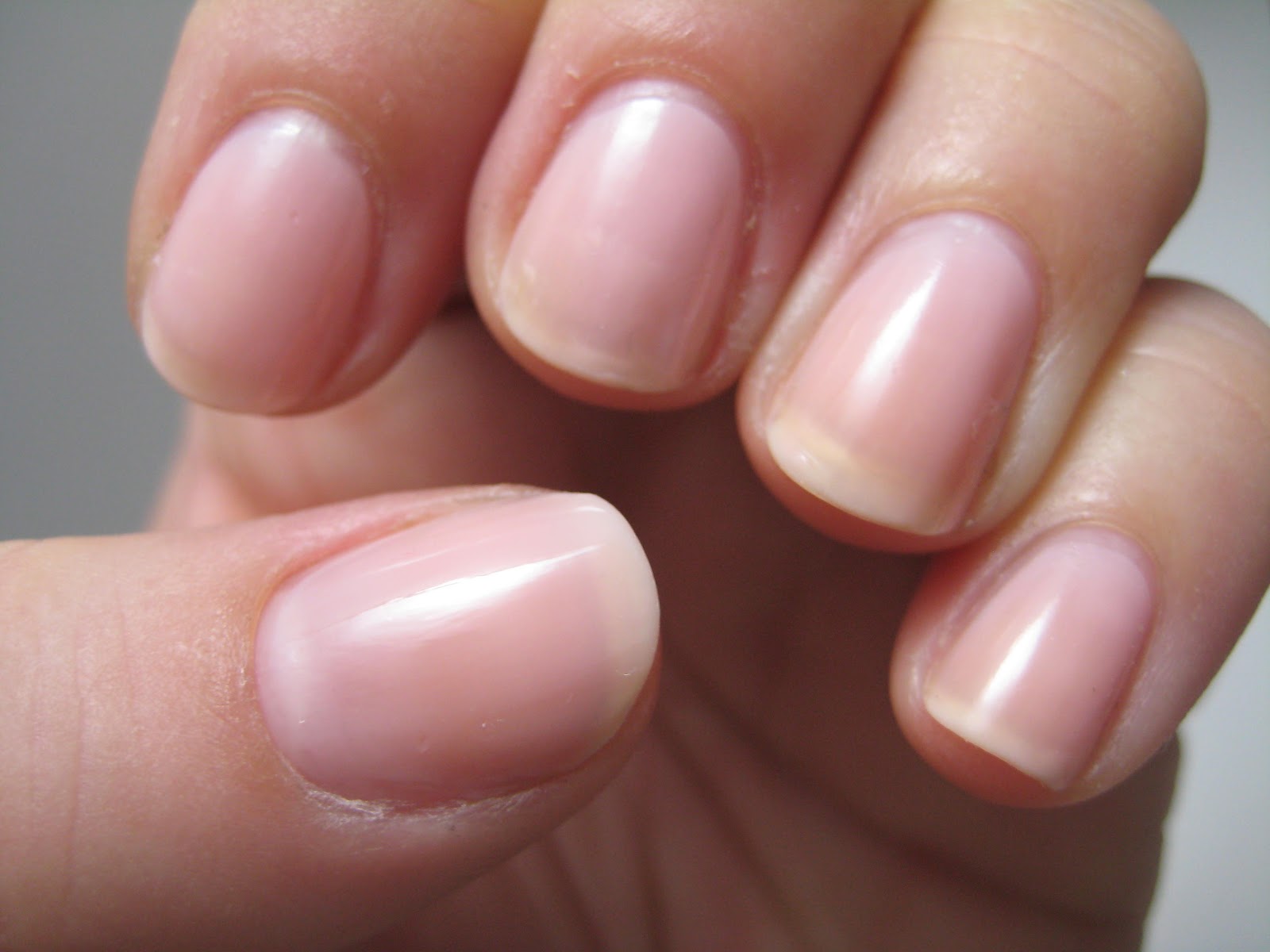 How to Improve the Color and Appearance of Your Nails - wide 5