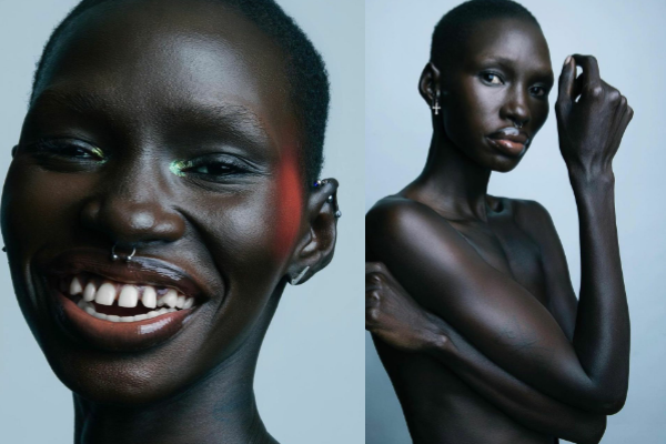 Mitchell Akat Celebrates Rare Beauty in New Shoot - SatisFashion Uganda